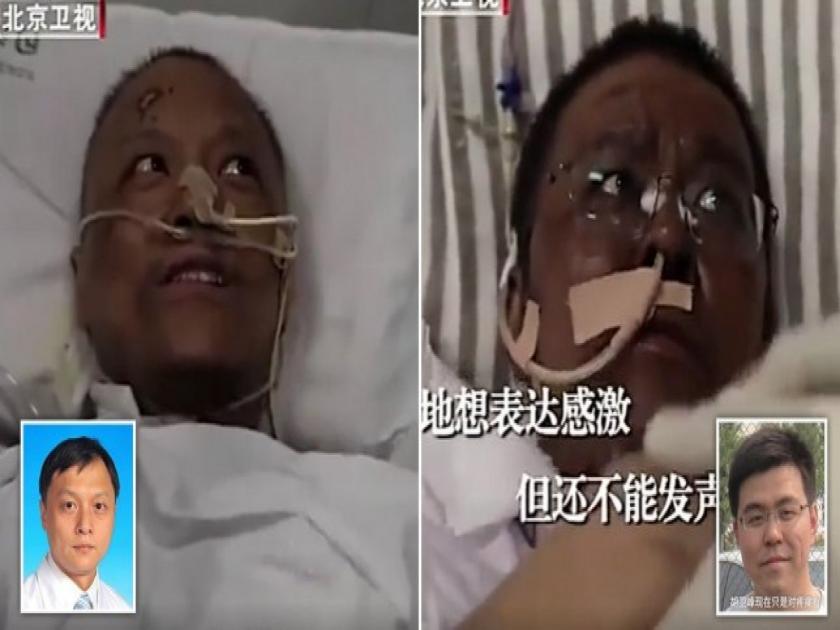 Coronavirus : Wuhan doctors wake from fighting virus to find skin has changed colour api | Coronavirus : कोरोनाग्रस्तांवर उपचार करणाऱ्या दोन डॉक्टरांच्या त्वचेचा रंग पडला काळा...