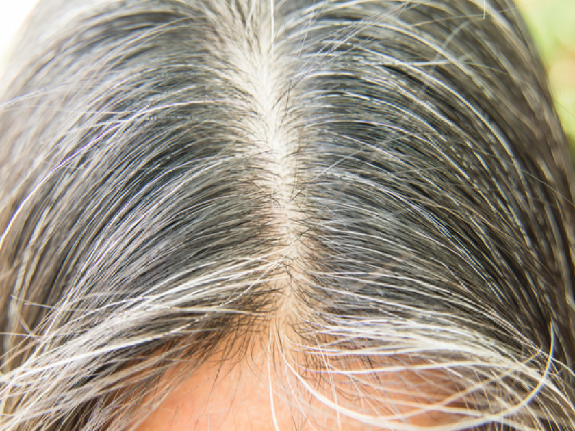 how to color white or grey hair naturally at home, remedies to stop white hair | तरुण वयात केस पांढरे होतायत? घाबरु नका, 'या' नैसर्गिक उपायांनी राहतील केस कायमचे काळे