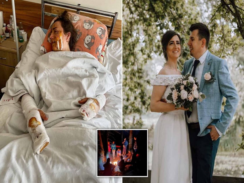Wife 31 injured brother friend killed honeymoon bloodbath WW1 bomb Ukraine | हनीमूनवर गेलं होतं कपल, तेव्हाच जमिनीखाली झाला बॉम्बस्फोट आणि मग....