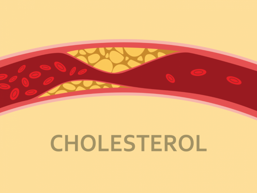 High cholestrol patients avoid this vagetable oil it can increases bad levels | High cholestrol : 'या' तेलाने वाढते शरीरात कोलेस्ट्रॉलची लेव्हल, अजिबात करू नका सेवन; नाही तर...