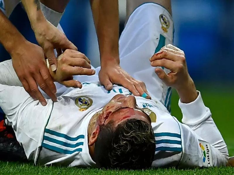  ... and Ronaldo was hit by a bloodbath, heading the player's feet while he was heading | रोनाल्डो झाला रक्तबंबाळ, हेडर मारताना खेळाडूचा पाय डोळ्याखाली लागला