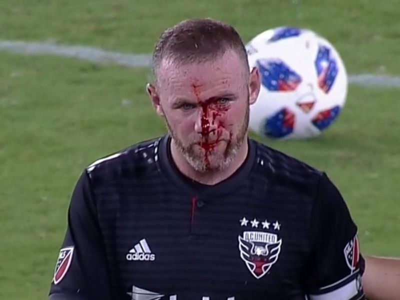 Major League Soccer: Wayne Rooney's face left covered in blood | Major League Soccer: रक्तबंबाळ वेन रूनीला पाहून चाहते घाबरले