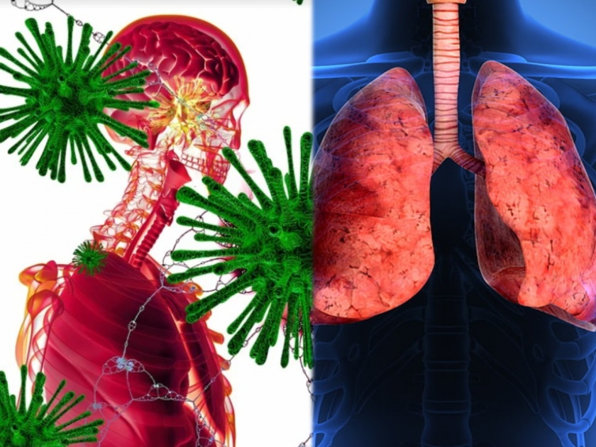 Corona virus patients may suffer from pulmonary fibrosis after covid-19 doctors warns | चिंताजनक! कोरोनातून बरं झाल्यानंतर फुफ्फुसांवर होतंय 'या' नवीन आजाराचं आक्रमण; तज्ज्ञांचा दावा