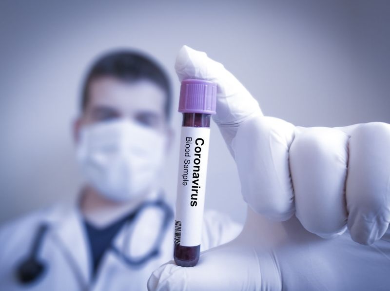 CoronaVirus in Nagpur: Number of pending samples increased in Nagpur:above 100 being checked daily | CoronaVirus in Nagpur : नागपुरात प्रलंबित नमुन्यांची संख्या वाढली : रोज १००वर तपासले जात आहेत नमुने