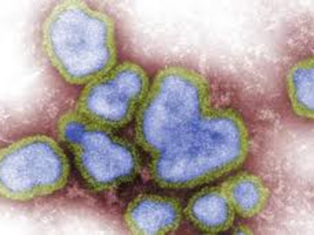 Coronavirus: After Corona crisis, now the Sari Virus patient found in Amravati | Coronavirus: कोरोनानंतर आता 'सारी'चं थैमान; औरंगाबादपाठोपाठ अमरावतीत २२ रुग्ण आढळले
