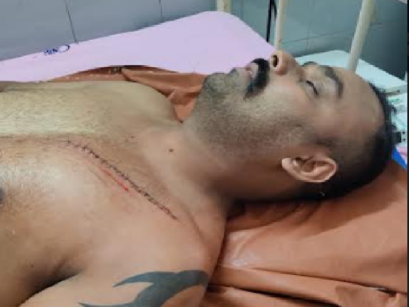 Sarpanch assaults Assistant Manager over land dispute, Incident in Dapoli | Ratnagiri: जमिनीच्या वादातून सरपंचांकडून सहायक व्यवस्थापकावर वार, दापोली तालुक्यातील घटना
