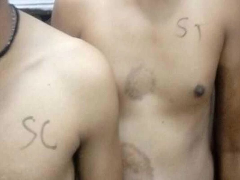 SC, ST, OBC markings seen on chests of recruits, MP police order probe | मी SC, मी ST...विद्यार्थ्यांनी छातीवर कोरली जात 