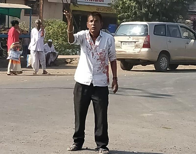 Shiv Sena activist injured himself by hitting blade | शिवसेनेचे सरकार स्थापन होत नसल्याने उद्विग्न शिवसैनिकाने स्वत:लाच ‘ब्लेड’ मारून केले जखमी 