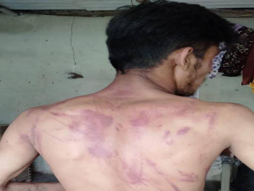 Video: Shiv Sena corporator assualted The young man, beaten with a belt and an iron rod in ambernath | Video : शिवसेना नगरसेवकाची दादागिरी; बेल्ट आणि लोखंडी रॉडने तरुणाला केली मारहाण