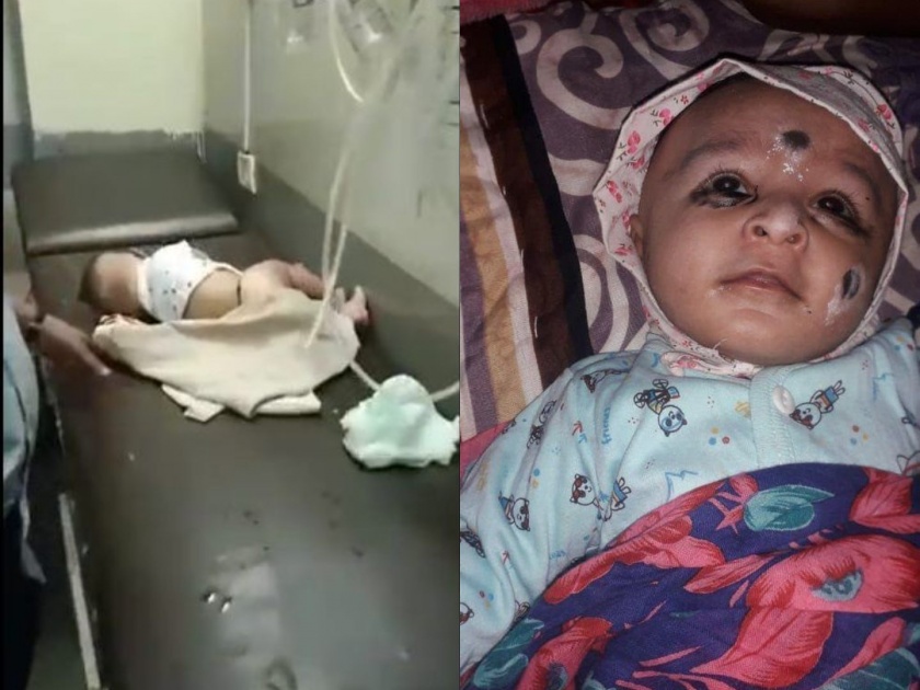 A child died due to irresponsible management of BMC Hospital Nitesh Rane criticizes Aditya Thackeray | भाजलेल्या बाळाला BMC रुग्णालयानं विव्हळत ठेवलं, Video पाहून तळपायाची आग मस्तकात जाईल