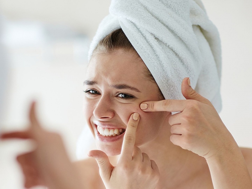 Easy remedies to get rid of pimples | सततच्या पिंपल्स येण्याने झाले असाल हैराण, तर 'या' सोप्या उपायांनी लगेच दूर करा पिंपल्स!