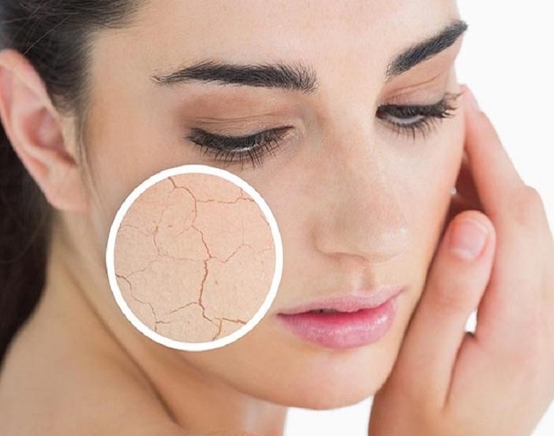 The most common skin problem in winter is dry skin | सीवम निर्मिती घटल्याने हिवाळ्यात त्वचा रुक्ष!, 'अशी' घ्या त्वचेची काळजी