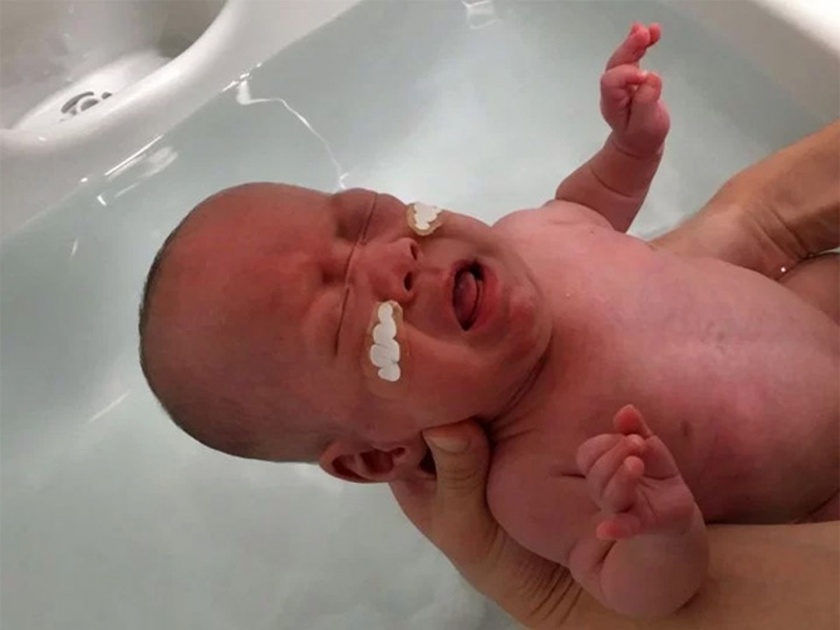 Smallest surviving baby boy ever born weighing 1lb finally goes home | जगातलं सर्वात लहान जिवंत बाळ, वजन केवळ २६८ ग्रॅम!