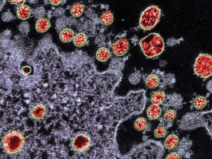 After the corona virus, Monkey B virus; 80% risk of death if left untreated | कोरोनानंतर चीनमध्ये आणखी एक व्हायरस आढळला; उपचार न घेतल्यास ८० टक्के मृत्यूचा धोका