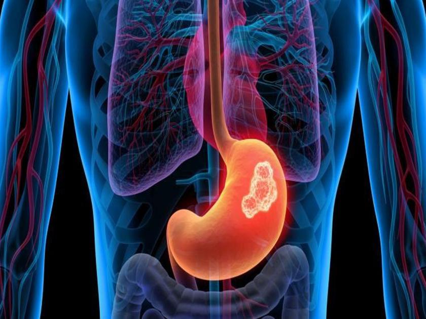 The digestive system will be strong and strong if you follow these habits, otherwise you will get serious illness | पचनसंस्था होईल मजबूत आणि स्ट्रॉंग जर लावाल 'या' सवयी, अन्यथा होतील गंभीर आजार