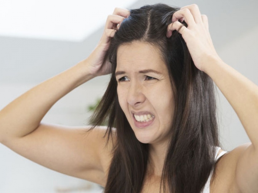 Hair fall problem increase in summer due to excessive sweating, Using these tips | जास्त घाम येणं केसांसाठी पडू शकतं महागात, अशी घ्या केसांची खास काळजी!