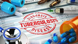 TB pataients will get subsidy of 500 rupees for healthy diet |  क्षयरुग्णांना सकस आहारासाठी मिळणार ५०० रुपये अर्थसहाय्य
