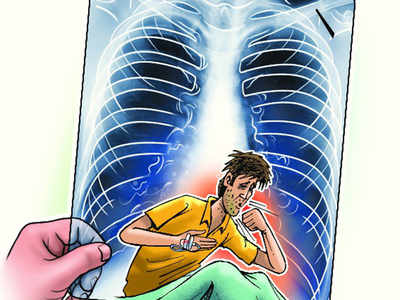 Three thousand TB patients per year in Buldhana district | बुलडाणा जिल्ह्यात वर्षाकाठी तीन हजारावर क्षयरुग्ण