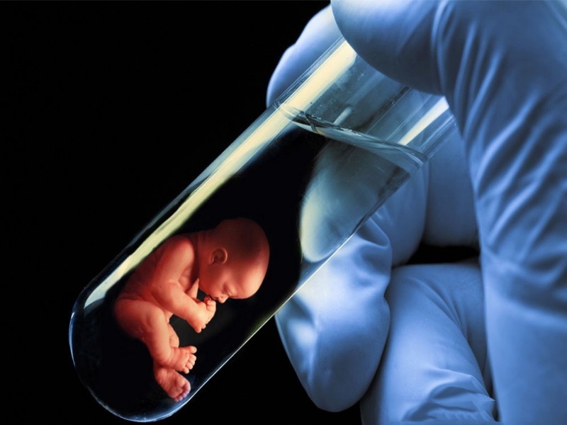 Invention of test tube baby technology; After 16 years, a woman gave birth to Lakshmi and Saraswati Parvati | टेस्ट ट्यूब बेबी तंत्रज्ञानाचा आविष्कार; १६ वर्षांनी महिलेने दिला लक्ष्मी, सरस्वती अन् पार्वतीला जन्म  
