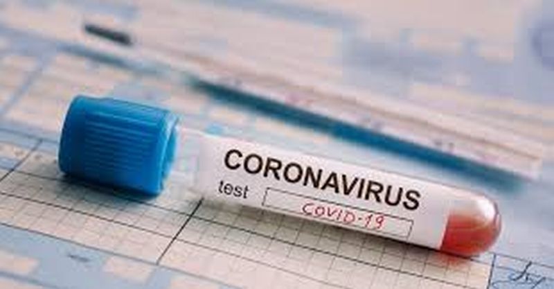 CoronaVirus in Akola: 19 more positive; The total number of patients is 3195 | CoronaVirus in Akola :  आणखी १९ पॉझिटिव्ह; एकूण रुग्णसंख्या ३१९५