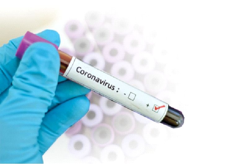 Corona Virus in Buldhana: Positivity rate of three talukas above 20% | CoronaVirus in Buldhana : तीन तालुक्यांचा पॉझिटिव्हीटी रेट २० टक्क्यांच्या वर 