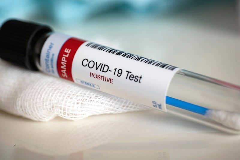 Coronavirus in Akola: 39 positives per day; 28 corona free | CoronaVirus in Akola : दिवसभरात ३९ पॉझिटिव्ह; २८ जण कोरोनामुक्त