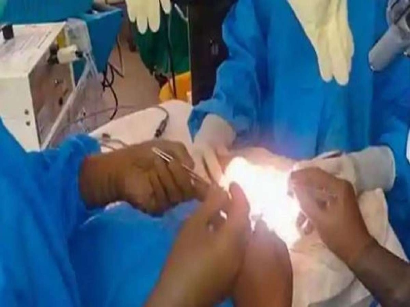16 kg lump removed from woman's abdomen; Rare surgery successful in Chandrapur | महिलेच्या पोटातून काढला १६ किलोचा गोळा; चंद्रपूरमध्ये दुर्मीळ शस्त्रक्रिया यशस्वी