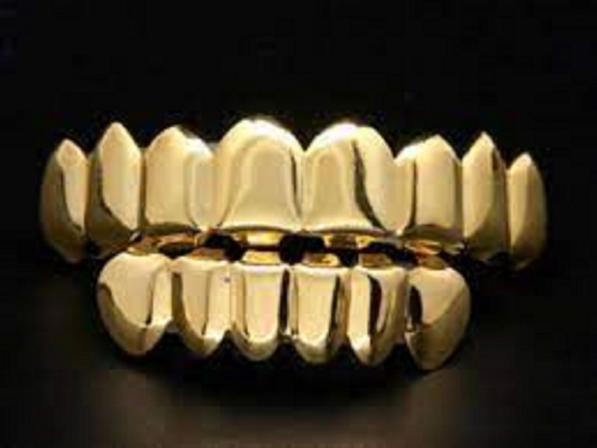 Gold price above Rs 52,000, don't want gold teeth, Baba! | सोन्याचा भाव ५२ हजारांवर, सोन्याचे दात नको रे बाबा! 