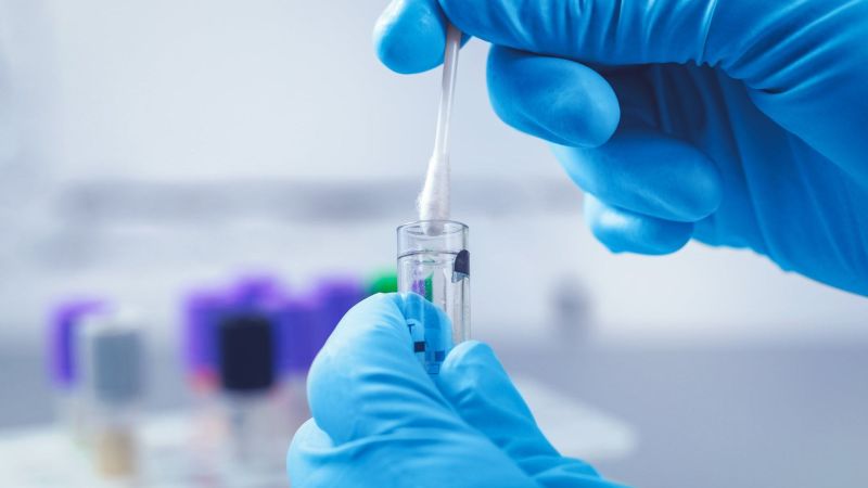 TB and HIV patients in Washim district will also be tested for corona | वाशिम  जिल्ह्यातील टीबी आणि एचआयव्ही रूग्णांचीही हाेणार कोरोनाची चाचणी
