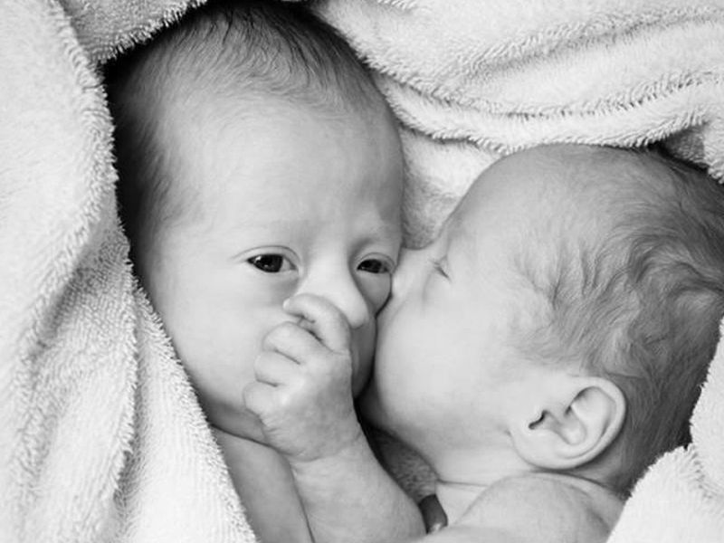 two twins hugging each other in mother's stomach | जन्माच्या आधीपासून पोटातच होते एकमेकांना घट्ट पकडून