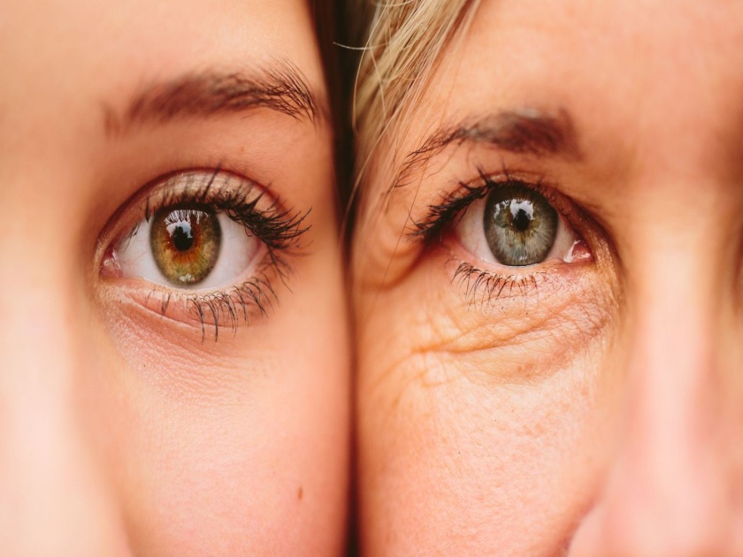 5 effective natural remedies to treat under eye wrinkles | डोळ्यांखाली सुरकुत्यांमुळे लूक बिघडलाय?; घेऊ नका टेन्शन, करा 'हे' उपाय