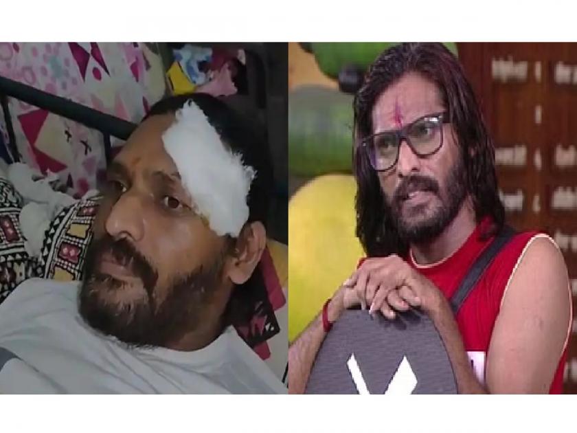 Abhijit Bichukle : Big Boss fame Abhijit Bichukle accident in Pune, head injury | Abhijit Bichukle : बिग बॉस फेम अभिजीत बिचुकलेचा पुण्यात अपघात, डोक्याला दुखापत