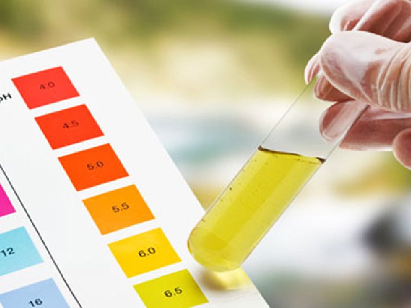 Urine color will tell you about your health | लघवीच्या रंगावरुन ओळखा तुमचं आरोग्य चांगलं की धोकादायक?
