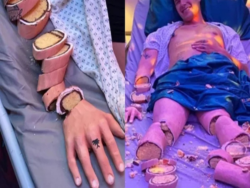 Man lying on a hospital bed is actually a bizarre cake pics goes viral | बाबो! सगळं सोडलं अन् माणसाच्या शरीराचा बनवला केक; फोटो पाहून तुम्हीही चकीत व्हाल