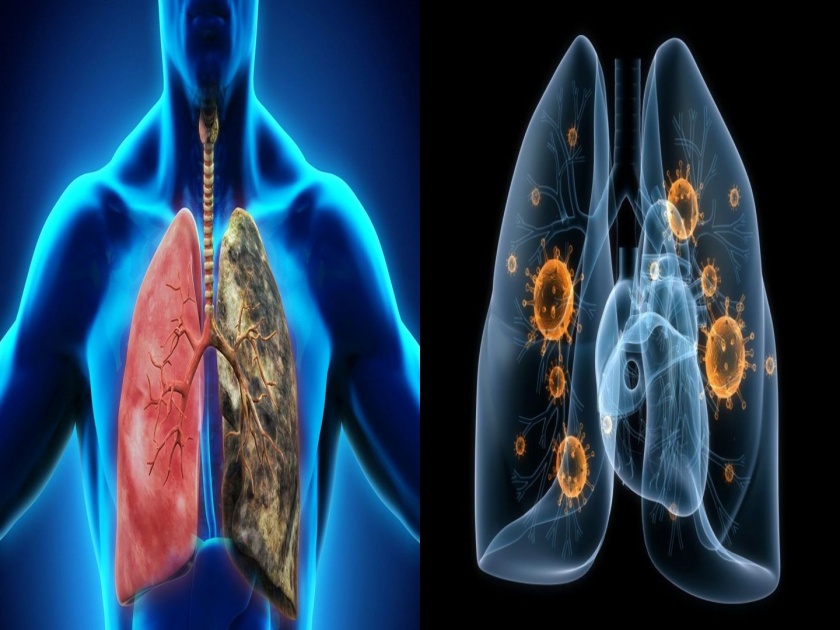 Lungs Health Tips : How to protect lungs from varies disease by using home remedies | दवाखान्यात जाण्याची वेळ येण्याआधी; 'या' घरगुती उपायांनी फुफ्फुसांना ठेवा संक्रमणापासून लांब