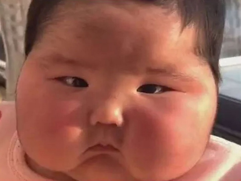 China baby face swelling like balloon after using a cream | बोंबला! आईनं चुकून भलतीच क्रिम लावली अन् चिमुरड्या लेकाचा चेहरा बघा कसा झाला....
