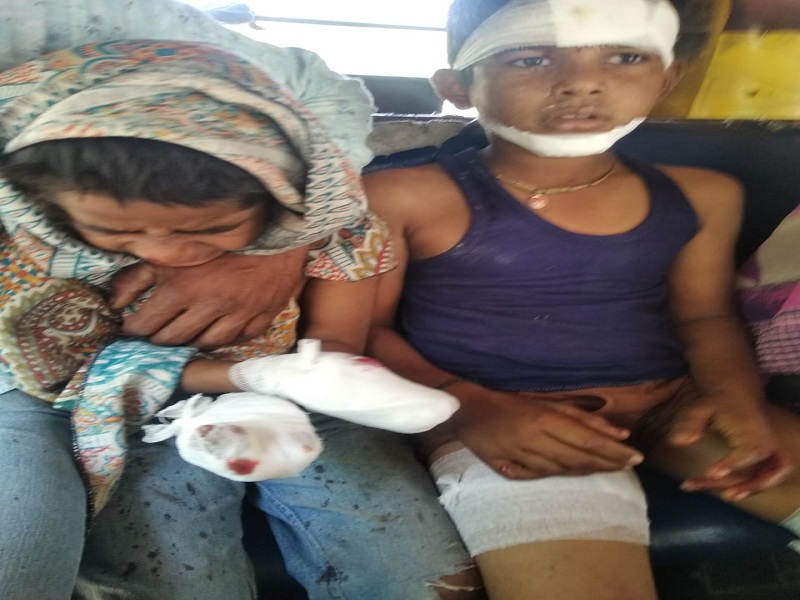 Siblings seriously injured in explosion of mobile battery at Vaijapur | मोबाईल बॅटरीसोबत खेळणे बेतले जीवावर; स्फोटात भावंडे गंभीर जखमी 
