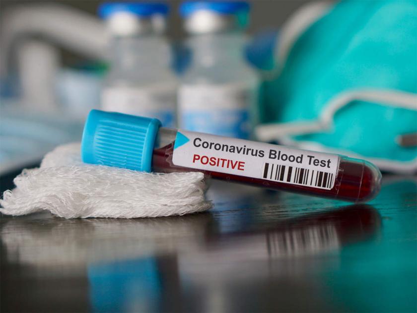 Coronavirus: More than two thousand corona patients in Mumbai; Diagnosis decreased by 35% | Coronavirus: मुंबईत दोन हजारांहून अधिक कोरोना रुग्ण; निदानाचे प्रमाण ३५ टक्क्यांनी घटले