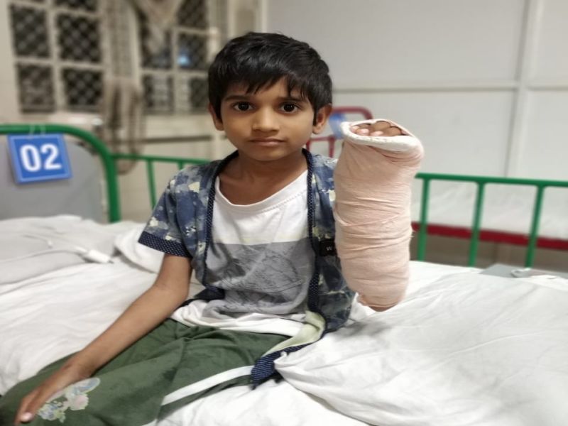 Mumbai : successful microvesicular hand surgery on 8 year old child at Wadia hospital | वाडिया हॉस्पिटलमध्ये 8 वर्षांच्या मुलाला मिळाली नवसंजीवनी,मोठी शस्त्रक्रिया यशस्वी