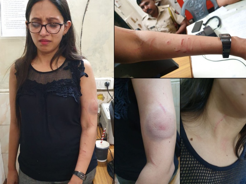 One girl was assaulted to other in a running local train | धावत्या लोकलमध्ये तरुणींत जुंपली ढिश्शुम-ढिश्शुम