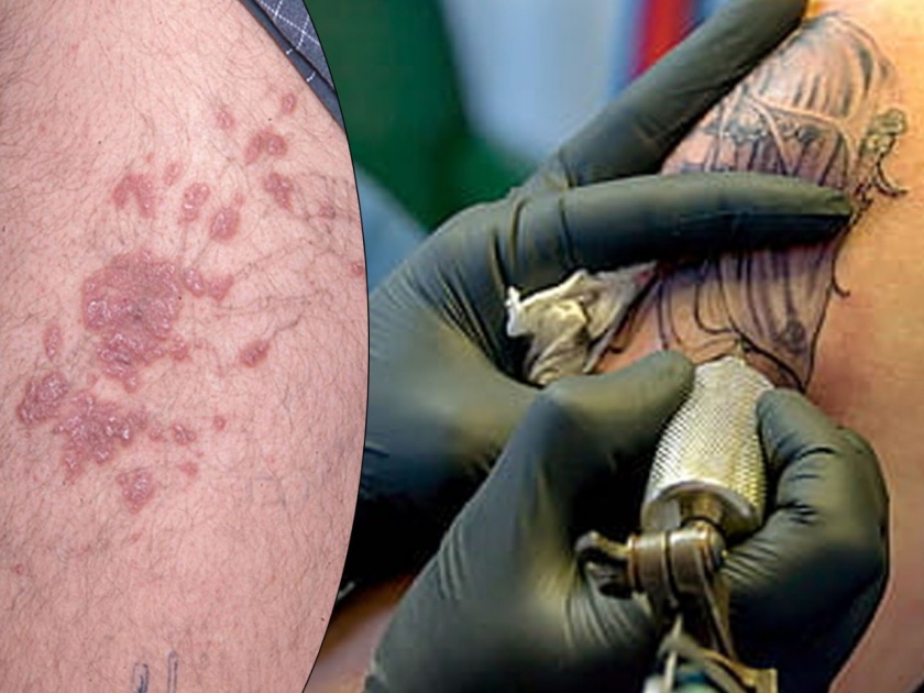 Take care of these things to prevent from tattoo infections | टॅटूमुळे होत असलेले इन्फेक्शन रोखण्यासाठी 'या' गोष्टींची घ्या काळजी