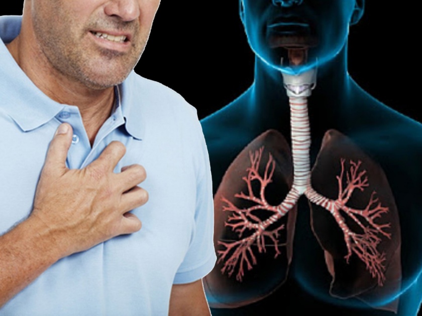 what is chest physiotherapy and how these therapies help to combat respiratory and lungs diseases MYB | श्वास घेण्यासाठी त्रास होत असेल टेंशन घेण्याआधी 'हा' प्रभावी उपाय वाचा....