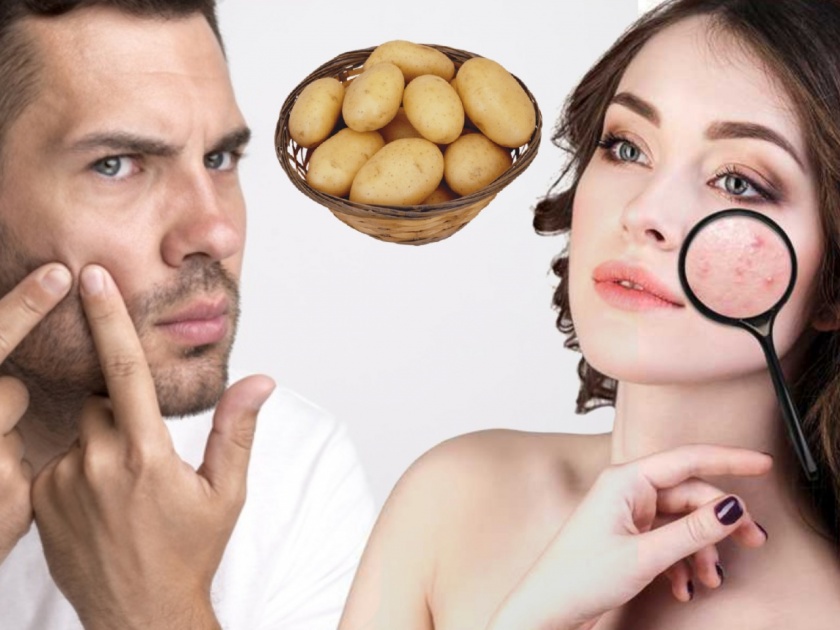 Row Potato benefits of skin potato can remove dark circles myb | लॉकडाऊनमध्ये पार्लरला सुट्टी? घरच्याघरी बटाटा वापरून मिळवा सुरकुत्या, टॅनिंगपासून सुटका