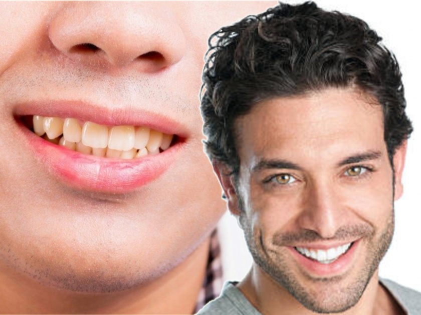 How to get white teeth at home without chemicals myb | दातांच्या पिवळटपणामुळे इंप्रेशन खराब होतंय? घरच्याघरी 'या' उपायांनी मिळवा चमकदार दात