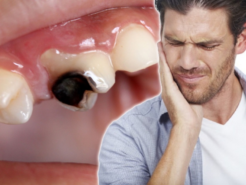 Tips to preserve tooth enamel and protect from cavities myb | दातदुखीमुळे अस्वस्थ होण्यापेक्षा आधीच 'या' उपायांनी दात, हिरड्या ठेवा निरोगी