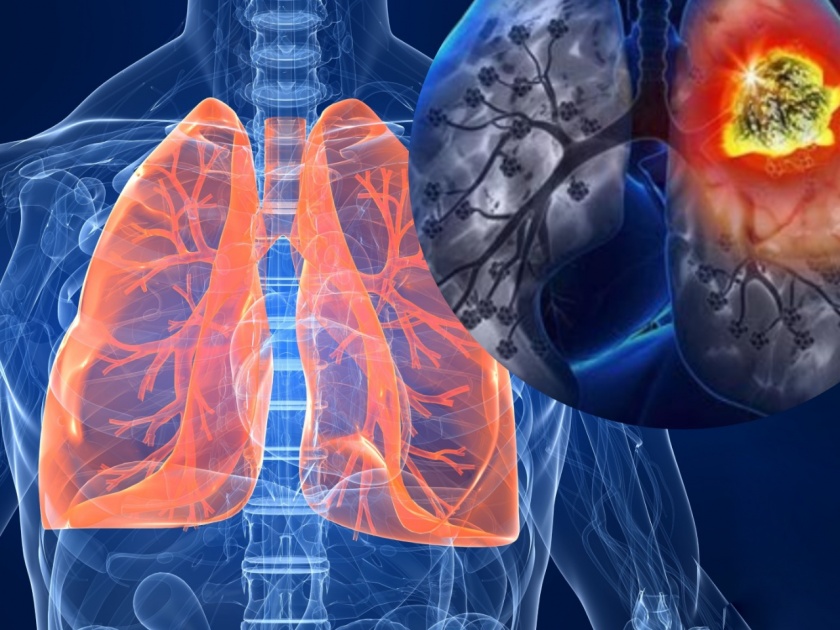 Health tips : How to prevent from lungs disease | 'या' ४ स्थितीत फुफ्फुसांचं होतं मोठं नुकसान; जाणून घ्या कोरोनाकाळात निरोगी राहण्याचे उपाय