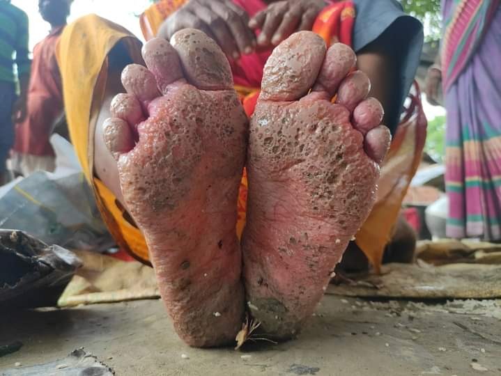 bihar flood picture of woman feet goes viral | Bihar Flood : नि:शब्द! बिहारला पुराचा तडाखा, मन हेलावून टाकणारा फोटो व्हायरल
