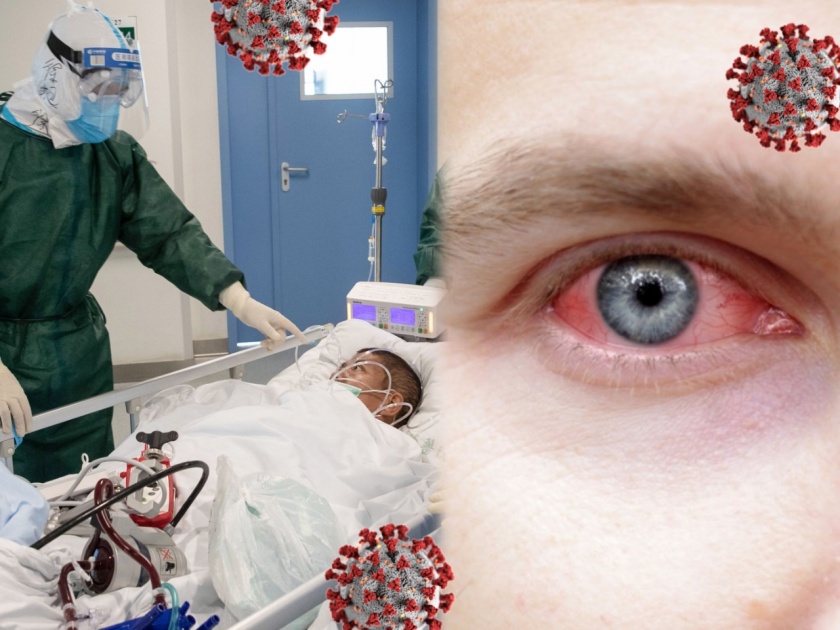 CoronaVirus News Marathi : sars cov 2 can not penetrate eyes cornea study finds | डोळ्यांच्या कॉर्नियावरही होऊ शकतो कोरोना व्हायरसचा परिणाम?; नव्या संशोधनातून खुलासा