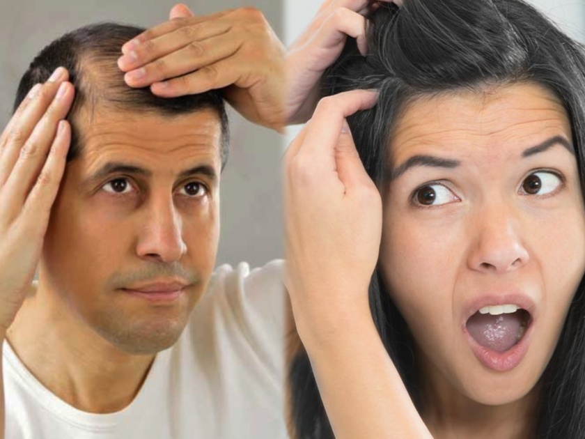 Hair Care Tips in Marathi : Home remedies for different hair problems by expert | गळणाऱ्या आणि पांढऱ्या केसांना वैतागलात? एक्सपर्ट्सनी  दिलेल्या ५ उपायांनी समस्या होतील दूर 