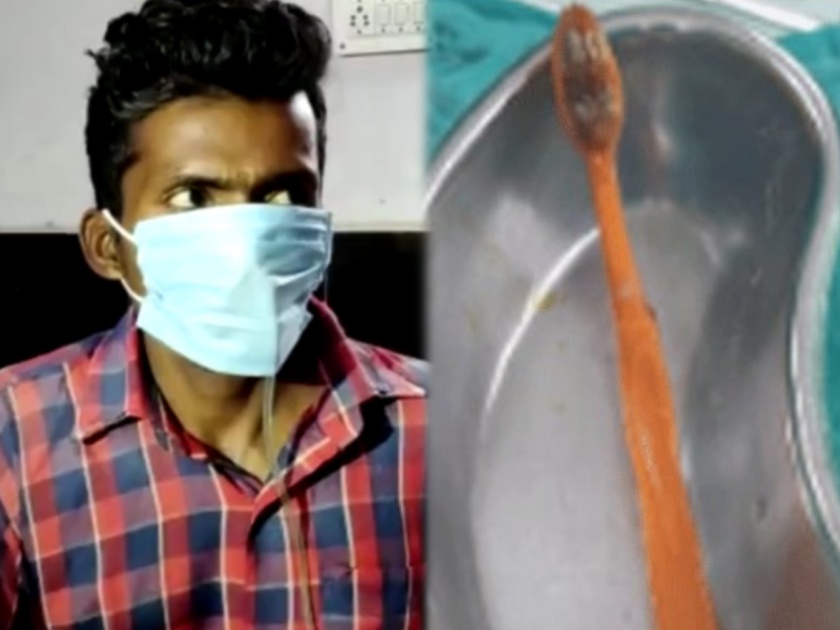 man swallowed toothbrush now what accidentally while cleaning teeth in aurangabad | काय सांगता? ...अन् तरुणाने गिळला अख्खा टूथब्रश, डॉक्टरही झाले हैराण